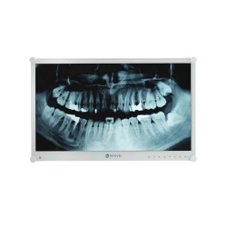 ECRAN 24'' MEDICAL FHD DP...
