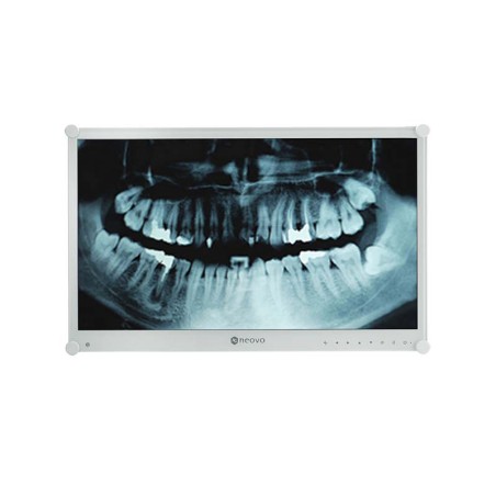 ECRAN 24'' MEDICAL FHD DP HDMI BNC METAL BLANC & DALLE VERRE 24V (PAS DE PIED)